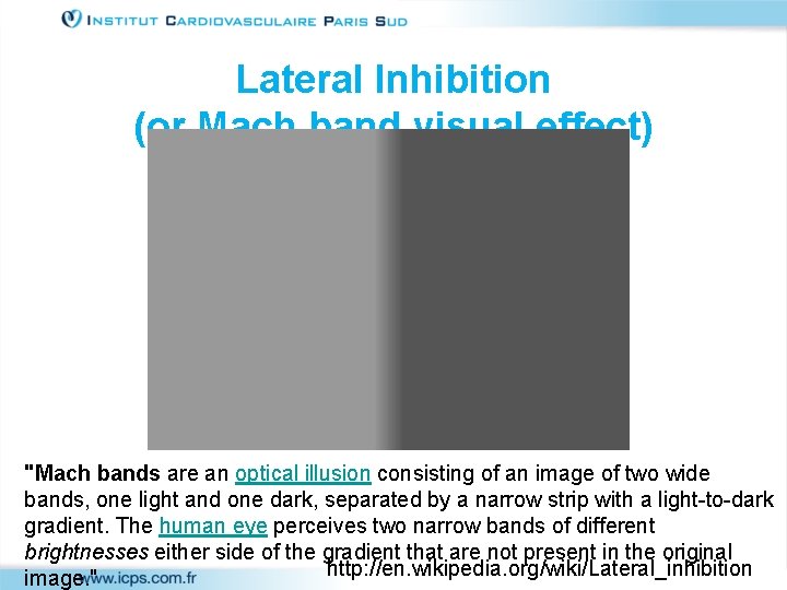 Lateral Inhibition (or Mach band visual effect) "Mach bands are an optical illusion consisting