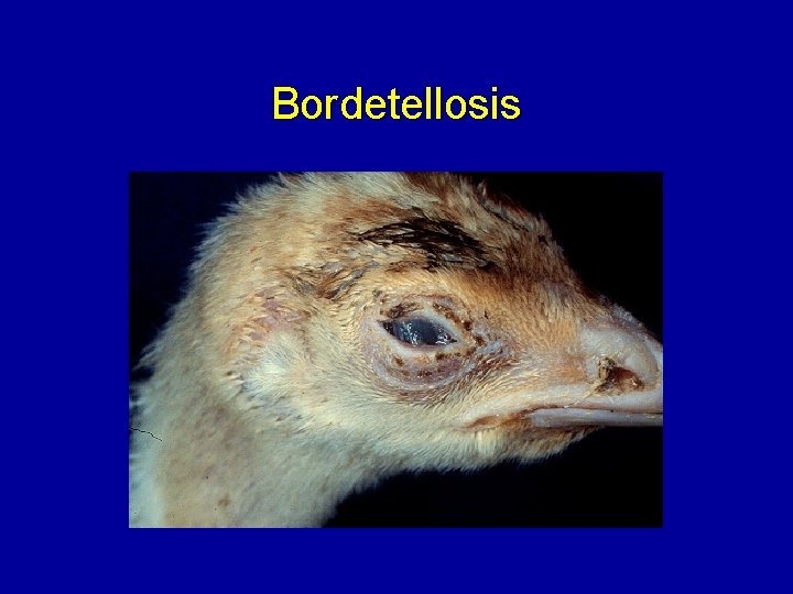 Bordetellosis 