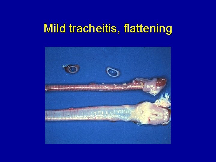 Mild tracheitis, flattening 