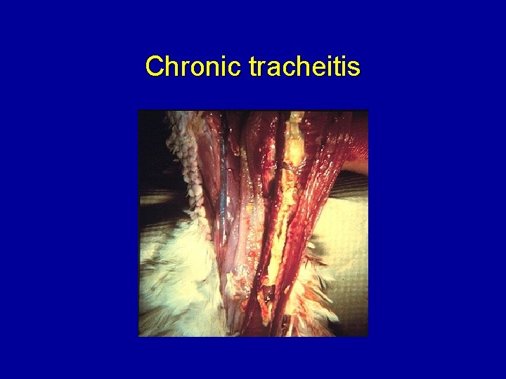 Chronic tracheitis 