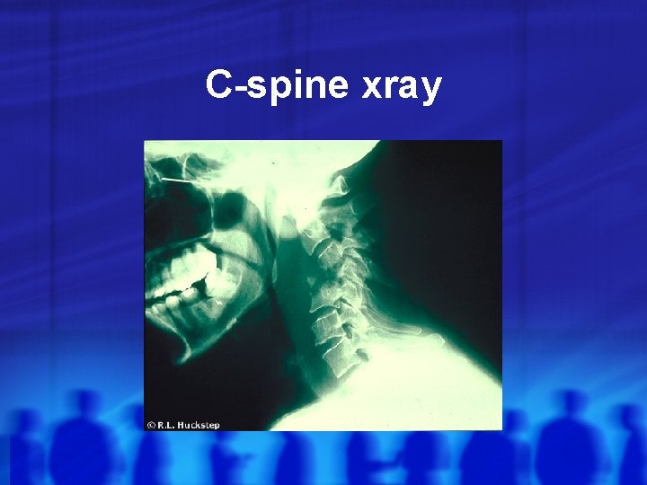 C-spine xray 