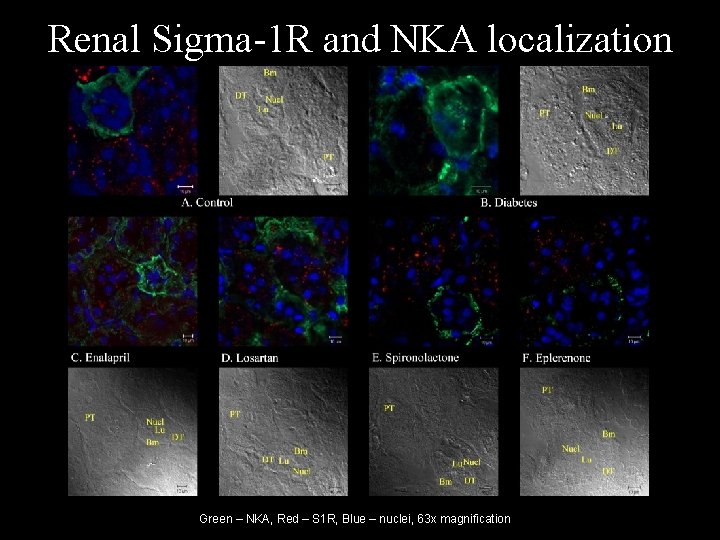 Renal Sigma-1 R and NKA localization Green – NKA, Red – S 1 R,