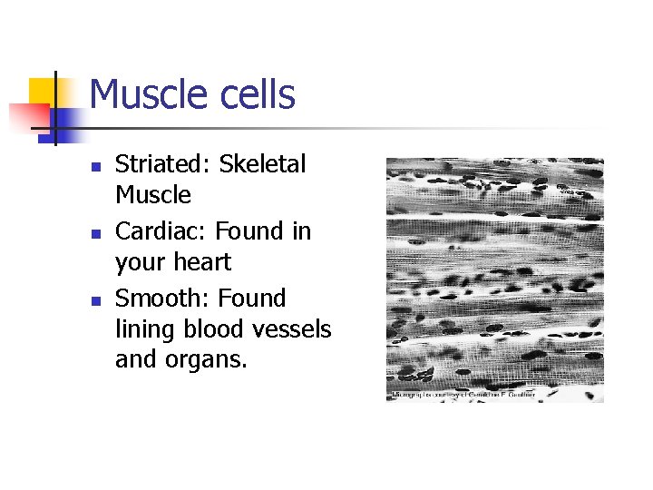Muscle cells n n n Striated: Skeletal Muscle Cardiac: Found in your heart Smooth: