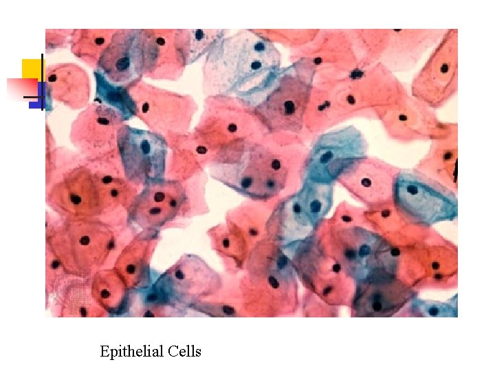 Epithelial Cells 