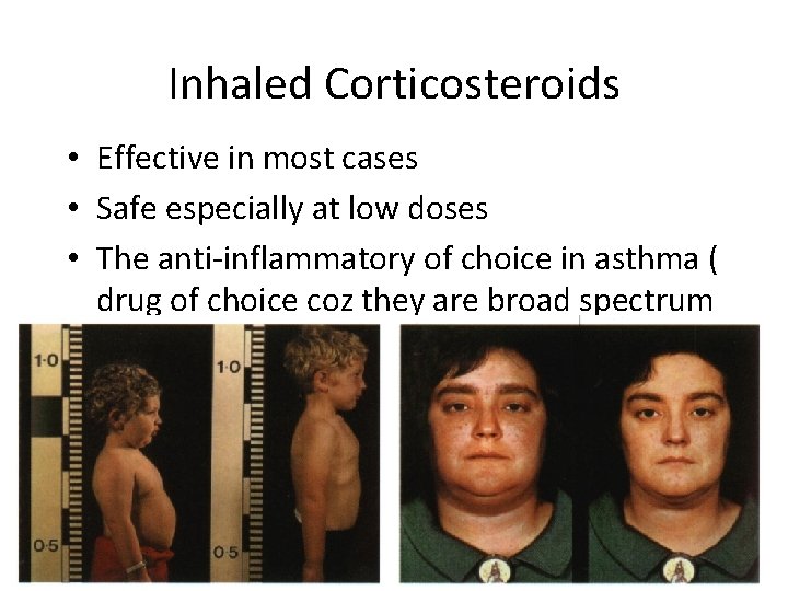 Inhaled Corticosteroids • Effective in most cases • Safe especially at low doses •