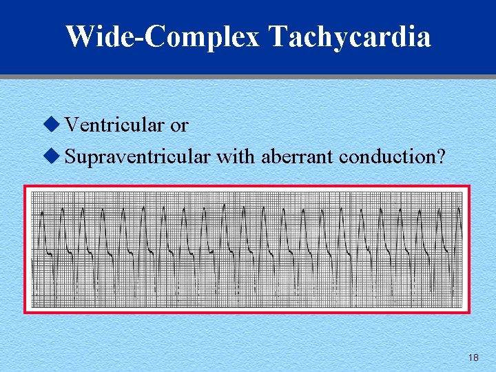 Wide-Complex Tachycardia u Ventricular or u Supraventricular with aberrant conduction? 18 