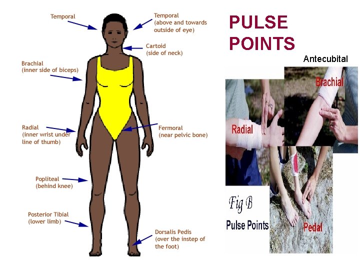 PULSE POINTS Antecubital 