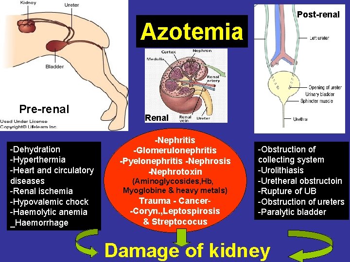 Post-renal Azotemia Pre-renal -Dehydration -Hyperthermia -Heart and circulatory diseases -Renal ischemia -Hypovalemic chock -Haemolytic