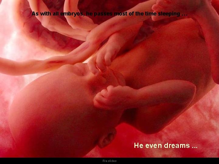 As with all embryos, he passes most of the time sleeping … He even