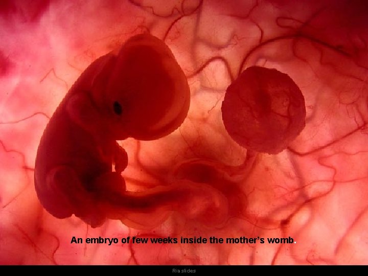 An embryo of few weeks inside the mother’s womb. Ria slides 