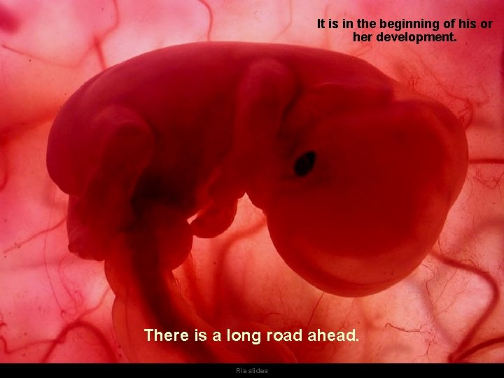 It is in the beginning of his or her development. There is a long