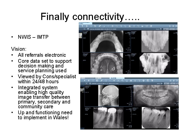 Finally connectivity…. . • NWIS – IMTP Vision: • All referrals electronic • Core
