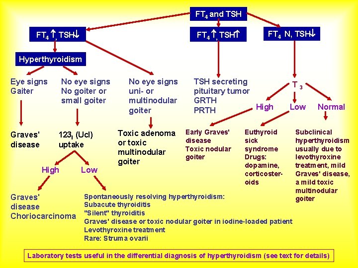 FT 4 and TSH FT 4 , TSH FT 4 N, TSH Hyperthyroidism Eye