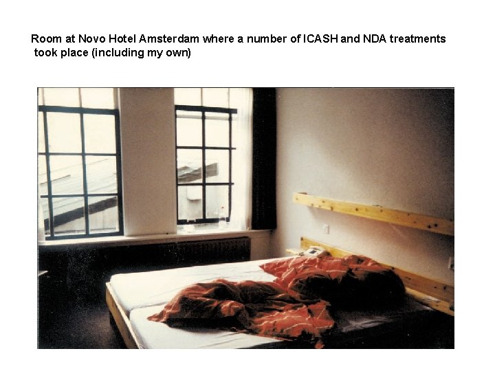 Room at Novo Hotel Amsterdam where a number of ICASH and NDA treatments took