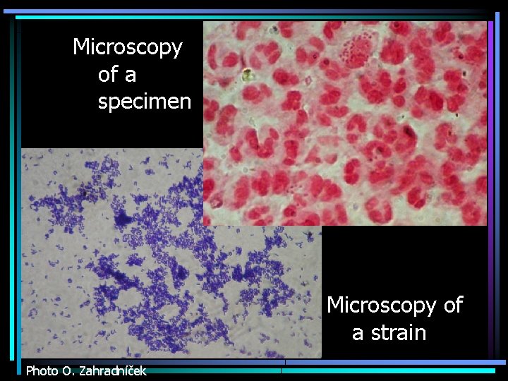 Microscopy of a specimen Microscopy of a strain Photo O. Zahradníček 