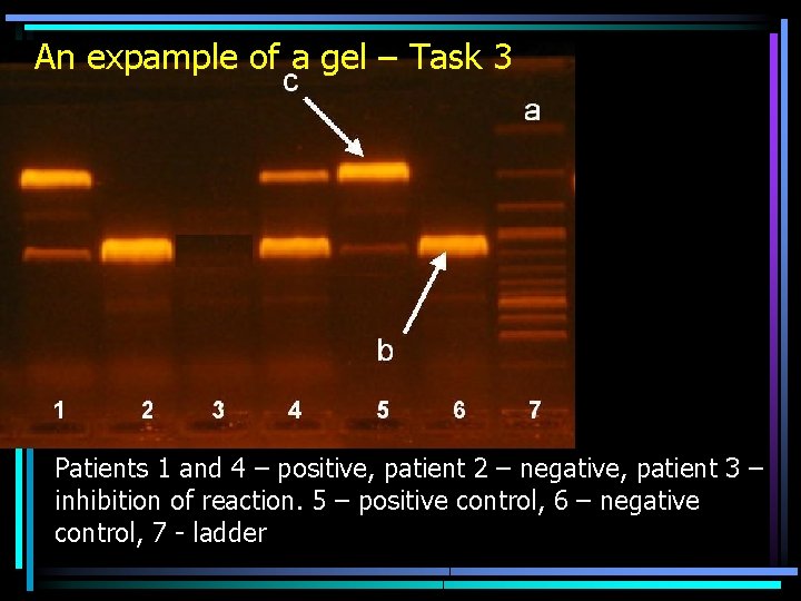 An expample of a gel – Task 3 Patients 1 and 4 – positive,