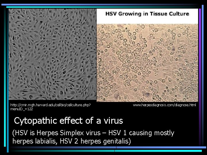 http: //cmir. mgh. harvard. edu/cellbio/cellculture. php? menu. ID_=122 www. herpesdiagnosis. com/diagnose. html Cytopathic effect