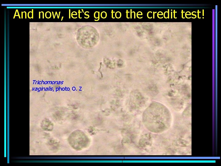 And now, let‘s go to the credit test! Trichomonas vaginalis, photo O. Z. 