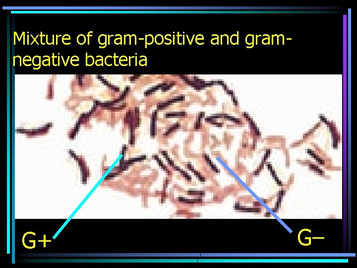 Mixture of gram-positive and gramnegative bacteria G+ G– 