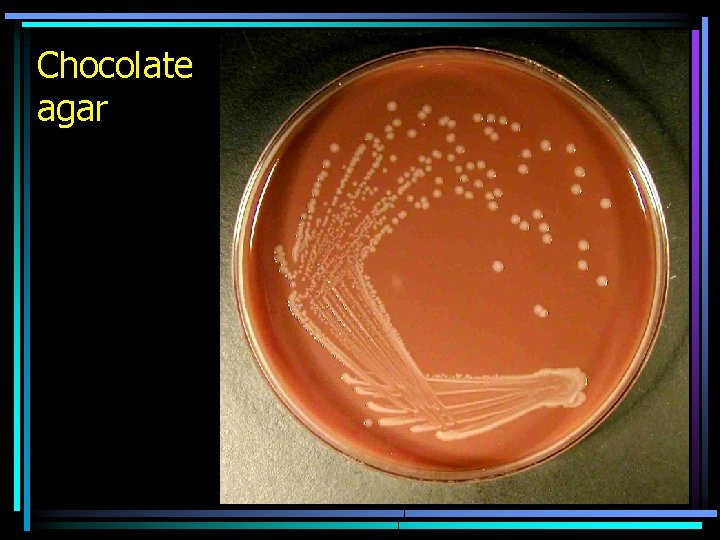 Chocolate agar 