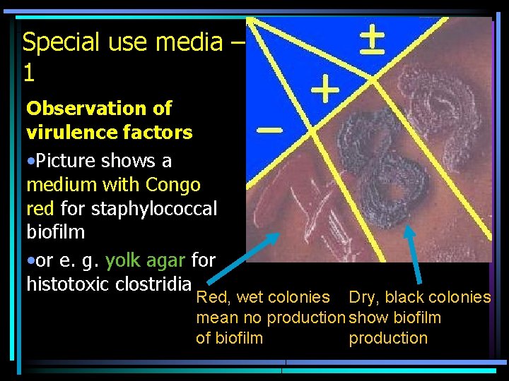 Special use media – 1 Observation of virulence factors • Picture shows a medium