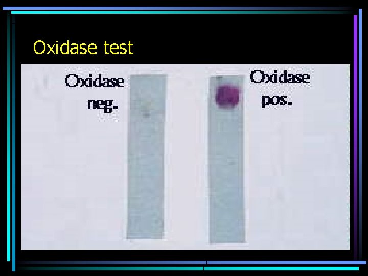 Oxidase test 