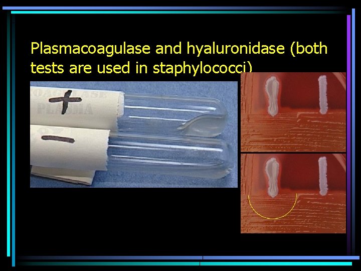 Plasmacoagulase and hyaluronidase (both tests are used in staphylococci) 