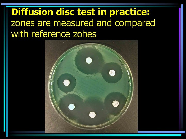 Diffusion disc test in practice: zones are measured and compared with reference zohes 