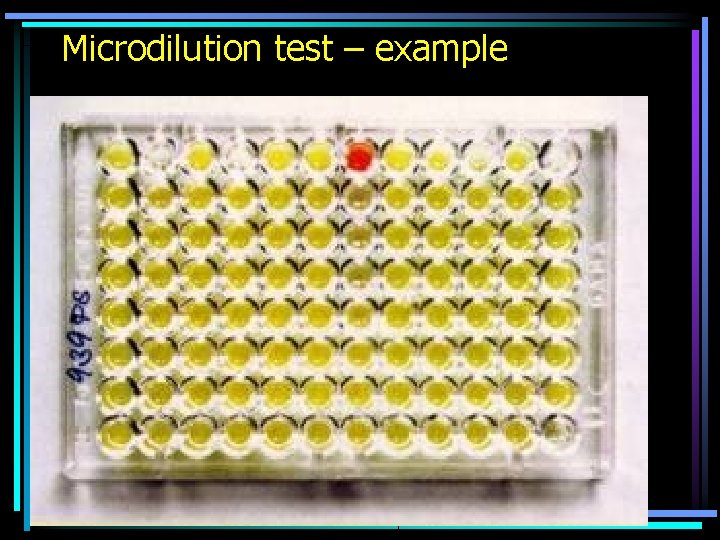 Microdilution test – example 