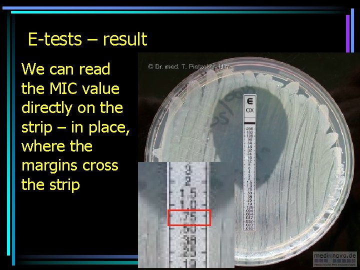 E-tests – result We can read the MIC value directly on the strip –