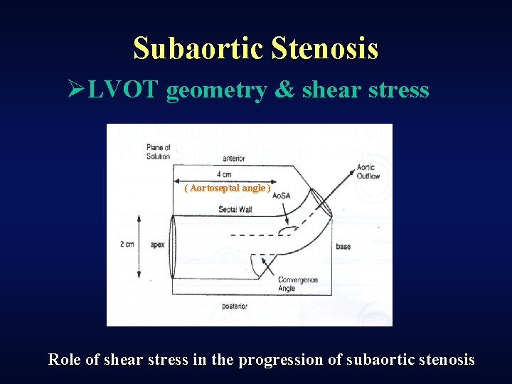 Subaortic Stenosis ØLVOT geometry & shear stress ( Aortoseptal angle ) Role of shear