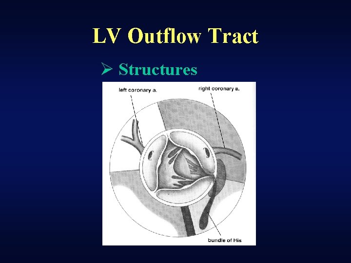 LV Outflow Tract Ø Structures 