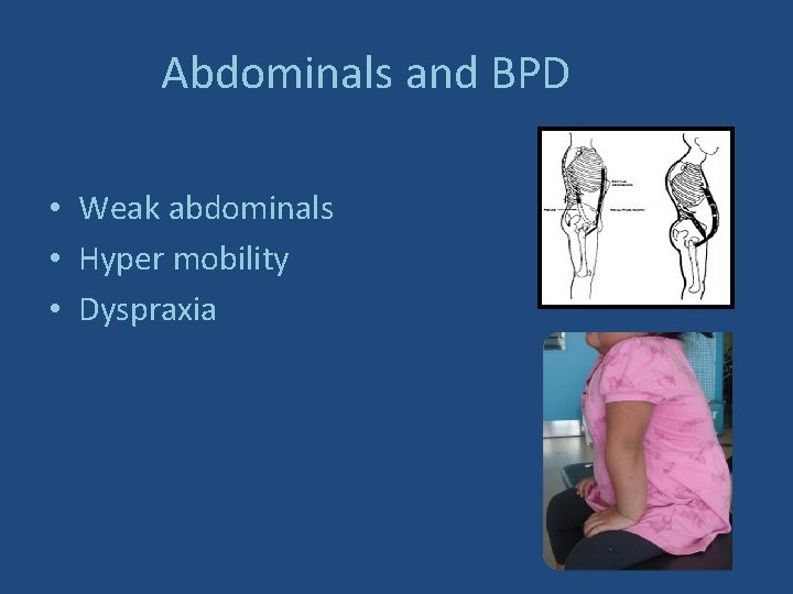 Abdominals and BPD • Weak abdominals • Hyper mobility • Dyspraxia 