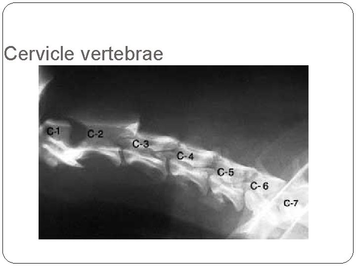 Cervicle vertebrae Cervicle vertebrae