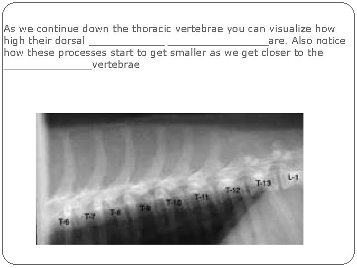 As we continue down the thoracic vertebrae you can visualize how high their dorsal