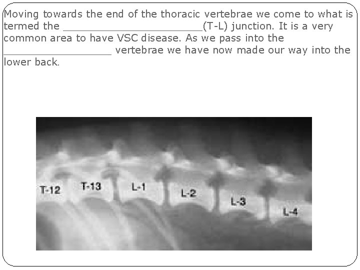 Moving towards the end of the thoracic vertebrae we come to what is termed Moving towards the end of the thoracic vertebrae we come to what is termed