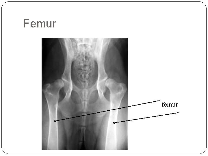 Femur femur Femur femur