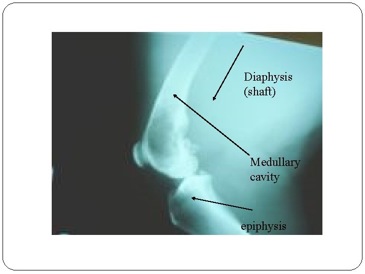 Diaphysis (shaft) Medullary cavity epiphysis Diaphysis (shaft) Medullary cavity epiphysis