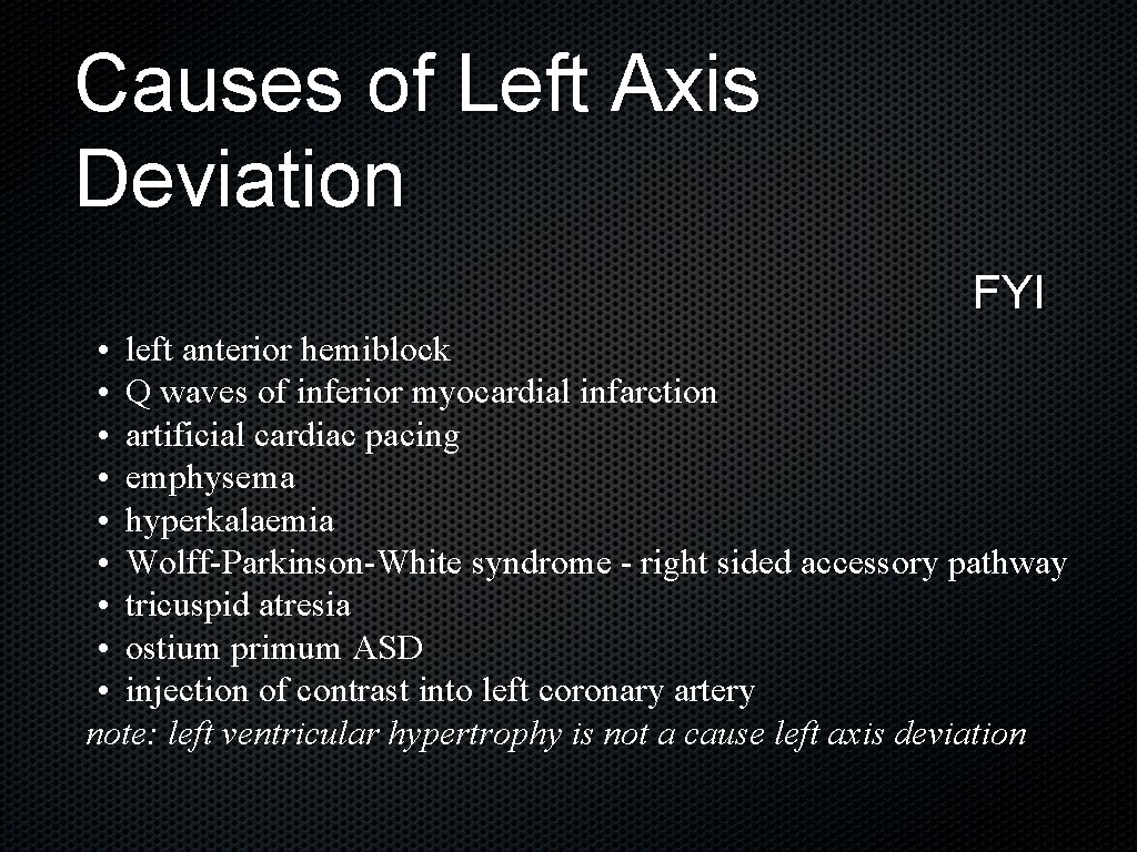 Causes of Left Axis Deviation FYI • left anterior hemiblock • Q waves of