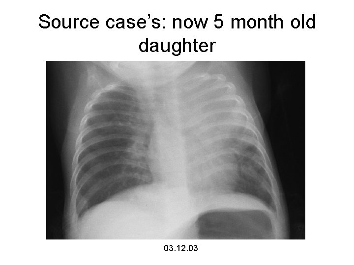 Source case’s: now 5 month old daughter 03. 12. 03 