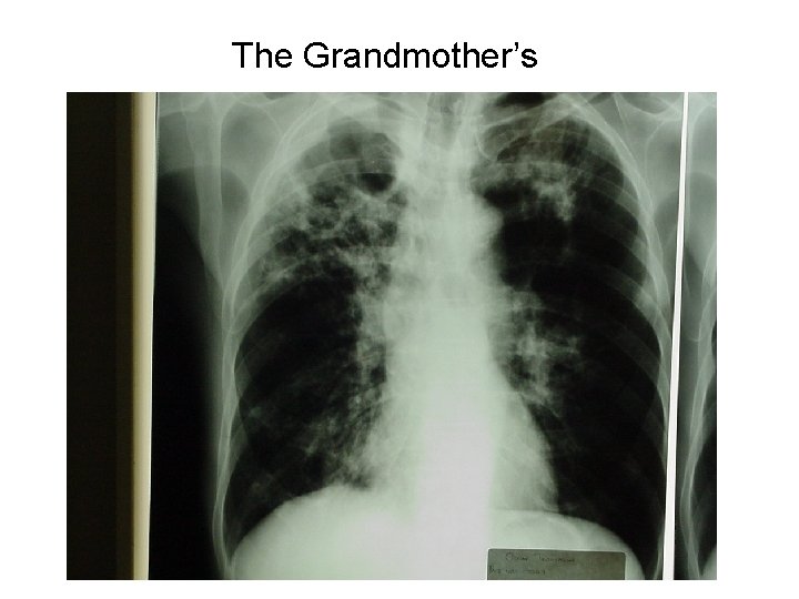 The Grandmother’s 