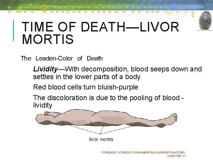 TIME OF DEATH—LIVOR MORTIS The Leaden-Color of Death Lividity—With decomposition, blood seeps down and