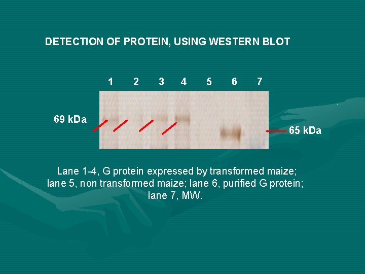 DETECTION OF PROTEIN, USING WESTERN BLOT 1 69 k. Da 2 3 4 5