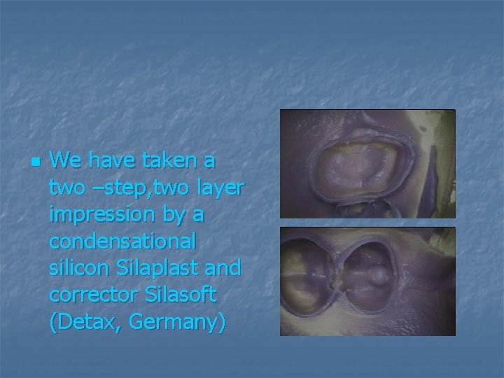 n We have taken a two –step, two layer impression by a condensational silicon