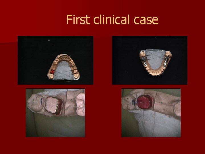 First clinical case 