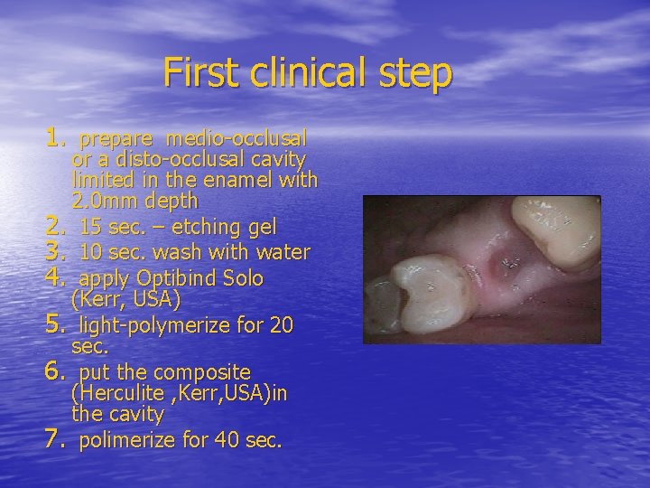 First clinical step 1. prepare medio-occlusal or a disto-occlusal cavity limited in the enamel