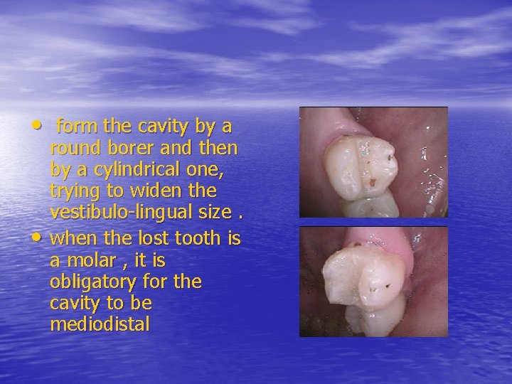  • form the cavity by a • round borer and then by a