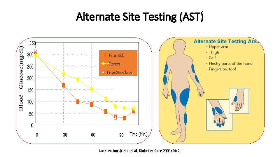 Alternate Site Testing (AST) Karsten Jungheim et al. Diabetes Care 2001; 24(7) 