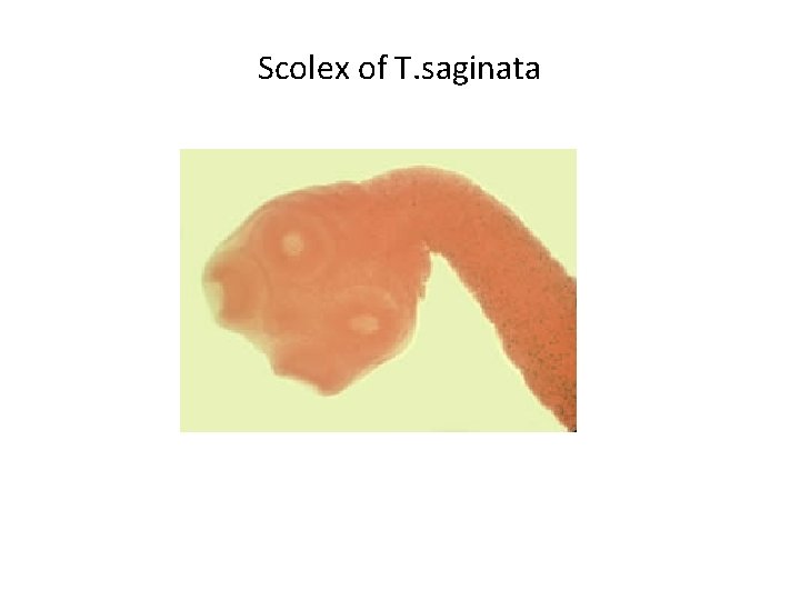 Scolex of T. saginata 