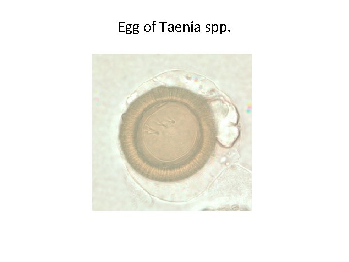 Egg of Taenia spp. 